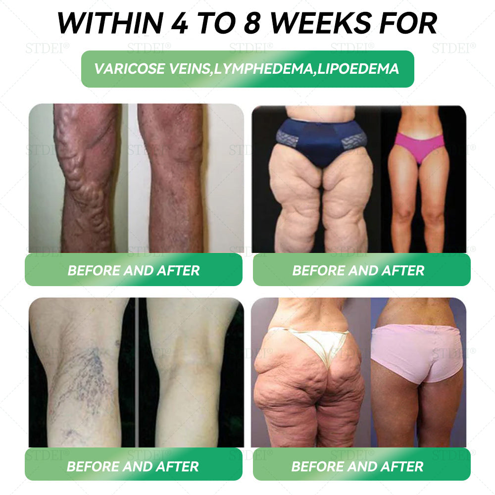 Only 10 boxes left! ⏰ Score an exclusive 30% off today! Endorsed by endocrinologists — 4 to 6 boxes recommended to keep the weight off and avoid rebound. Last chance before the new year rolls around — don’t miss out! 🔥